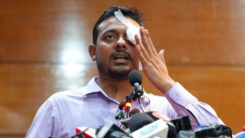 আলিফের ঘটনায় চোখে ব্যান্ডেজ বেঁধে প্রতিবাদ নাসীরুদ্দীনের